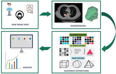 The Role of Radiomics in Lung Cancer: From Screening to Treatment and Follow-Up